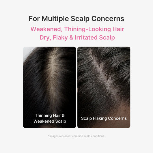 Rootly™